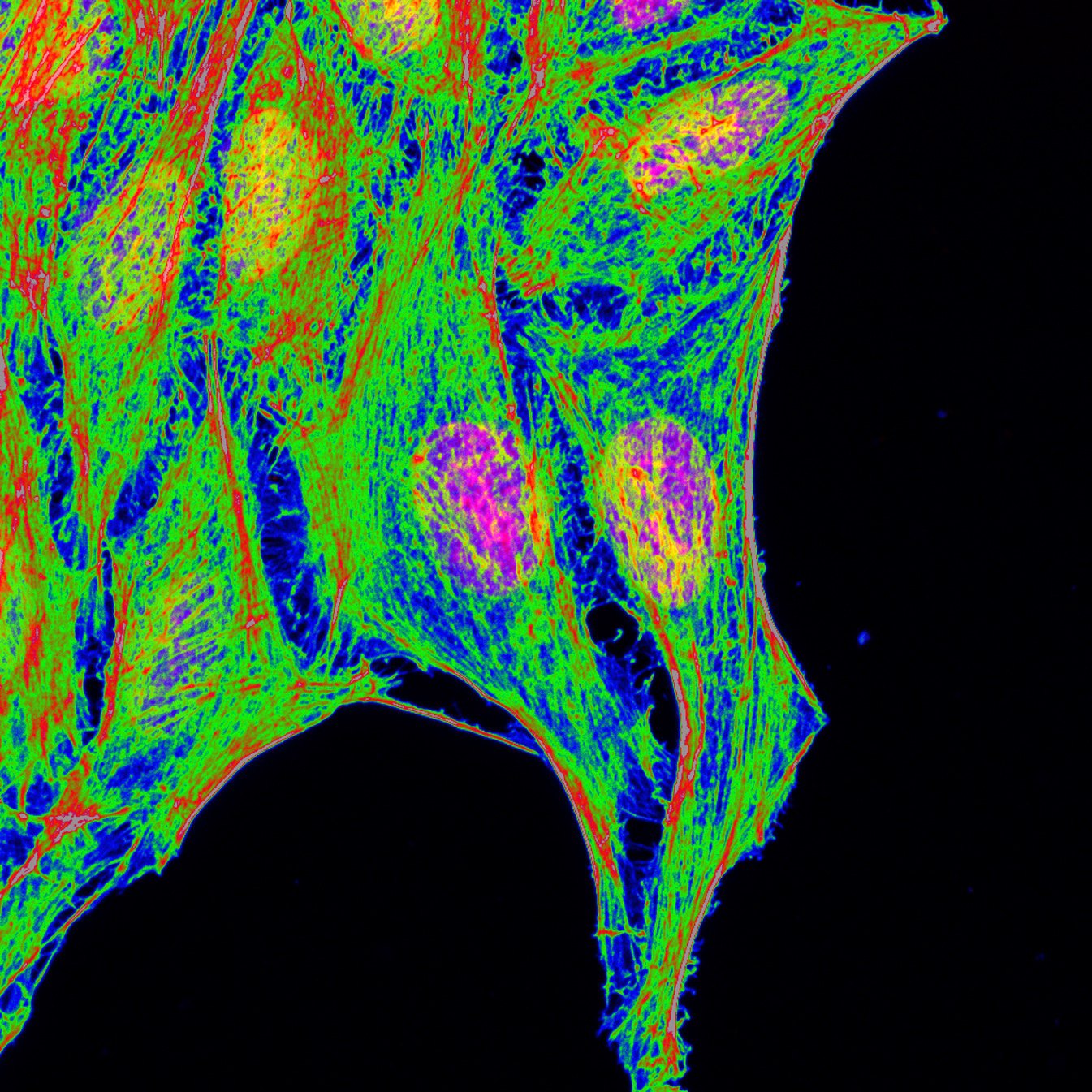 Confocal micrograph of stained HeLa