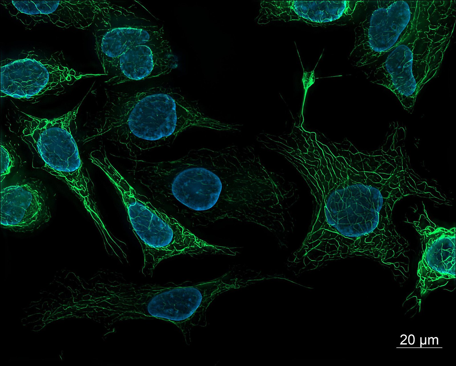 SK8-18-2 human derived cells, fluorescence microscopy (29942101073)