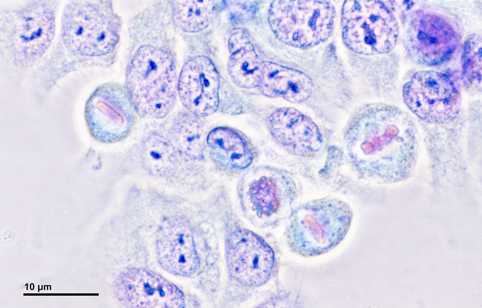 Cell culture (HeLa cells) (261 16) Cell culture (HeLa cells) - metaphase, prophase