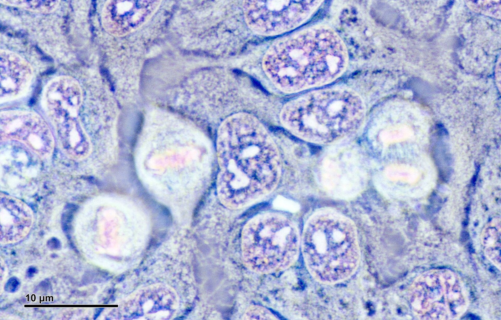 Cell culture (HeLa cells) (261 17) Cell culture (HeLa cells) - anaphase, metaphase