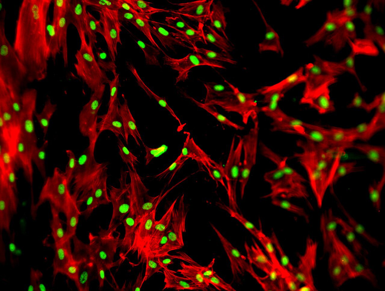 HELA cells stained with DAPI and Phalloidin
