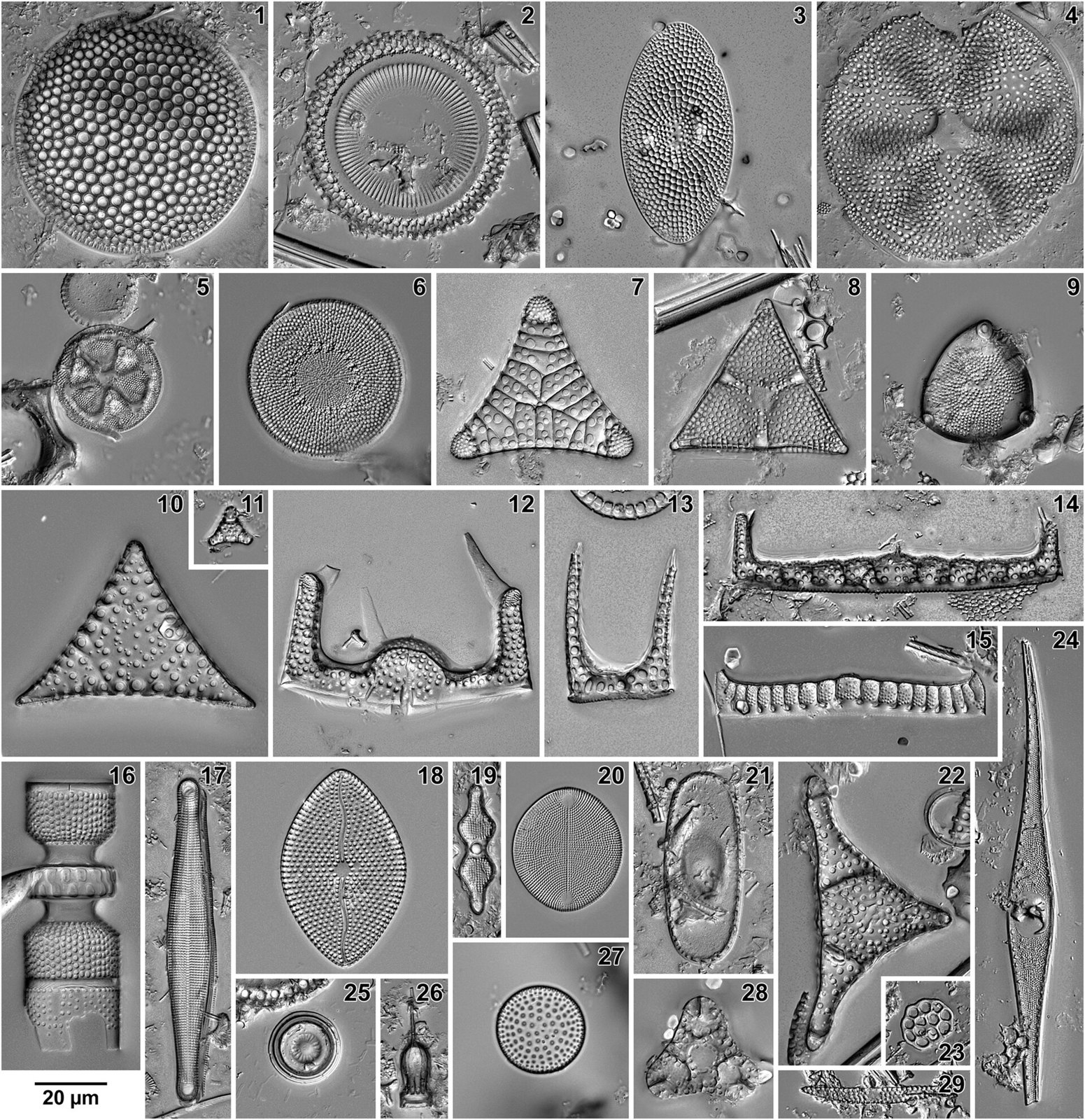 Eocene diatoms - Western North Atlantic