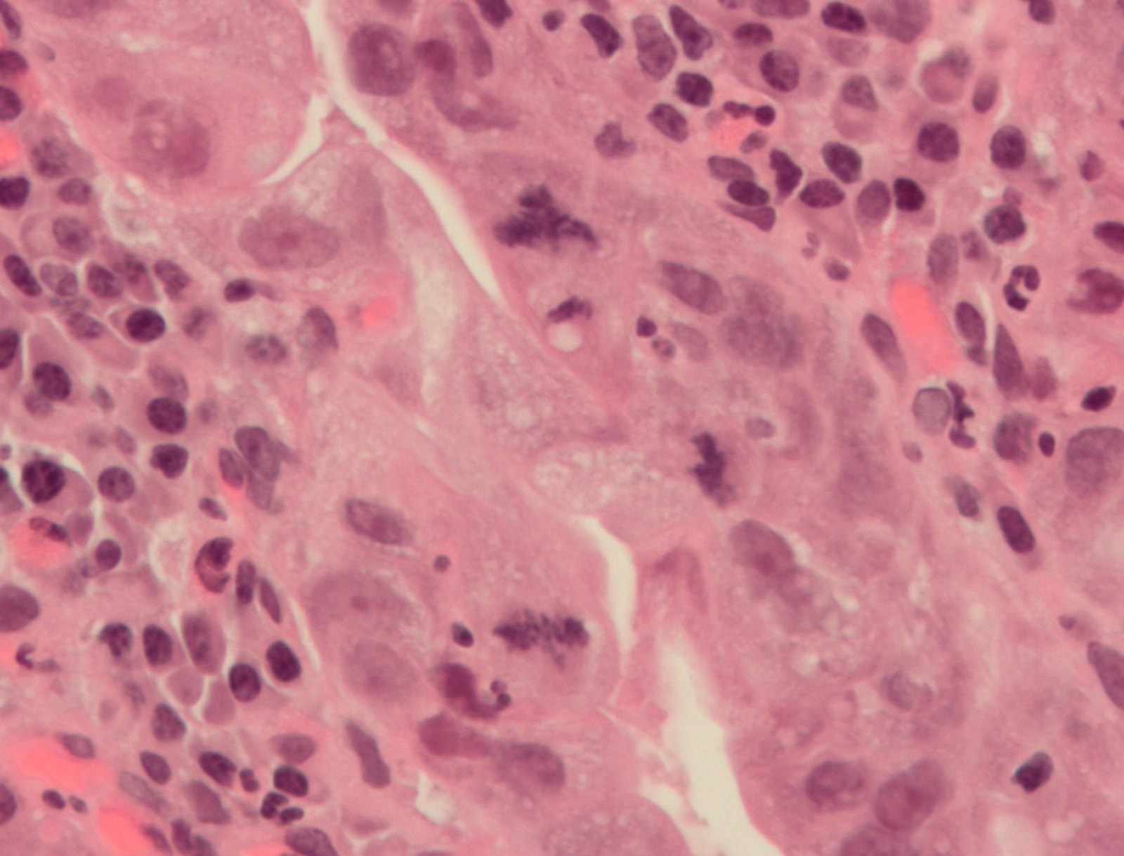 Atypical mitosis