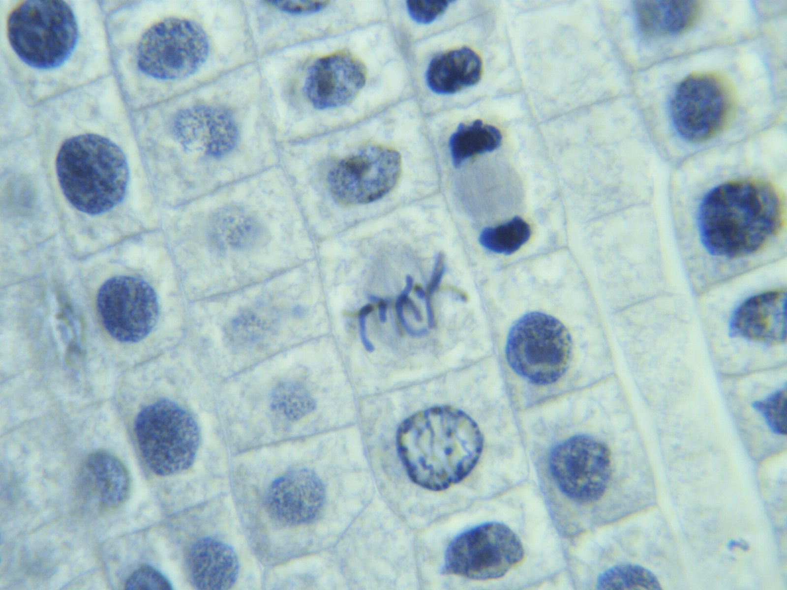 Mitosis in Onion Root - various stages (Metaphase and Telophase)