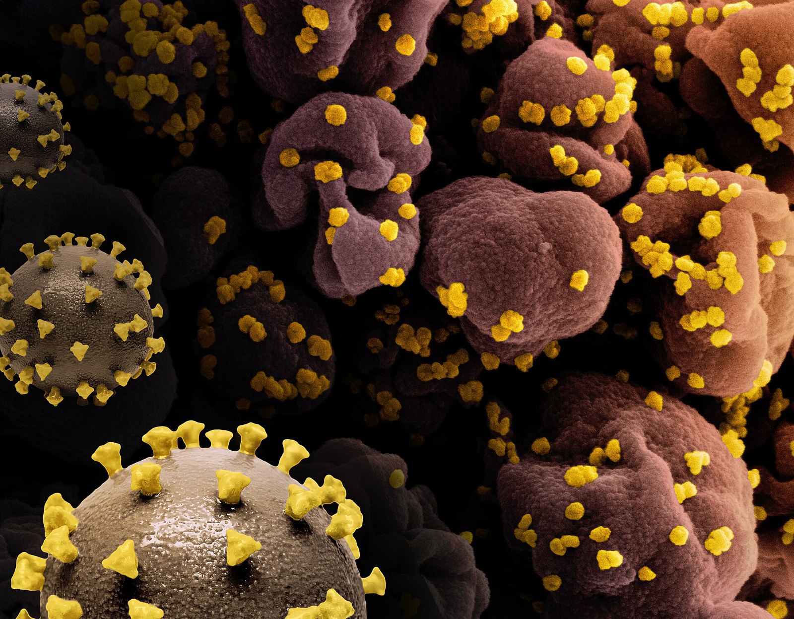 3D print models of SARS-CoV-2 virus (left, yellow spike proteins on a gray virus surface) and a colorized scanning electron micrograph of a cell infected with SARS-CoV-2 virus particles (yellow)