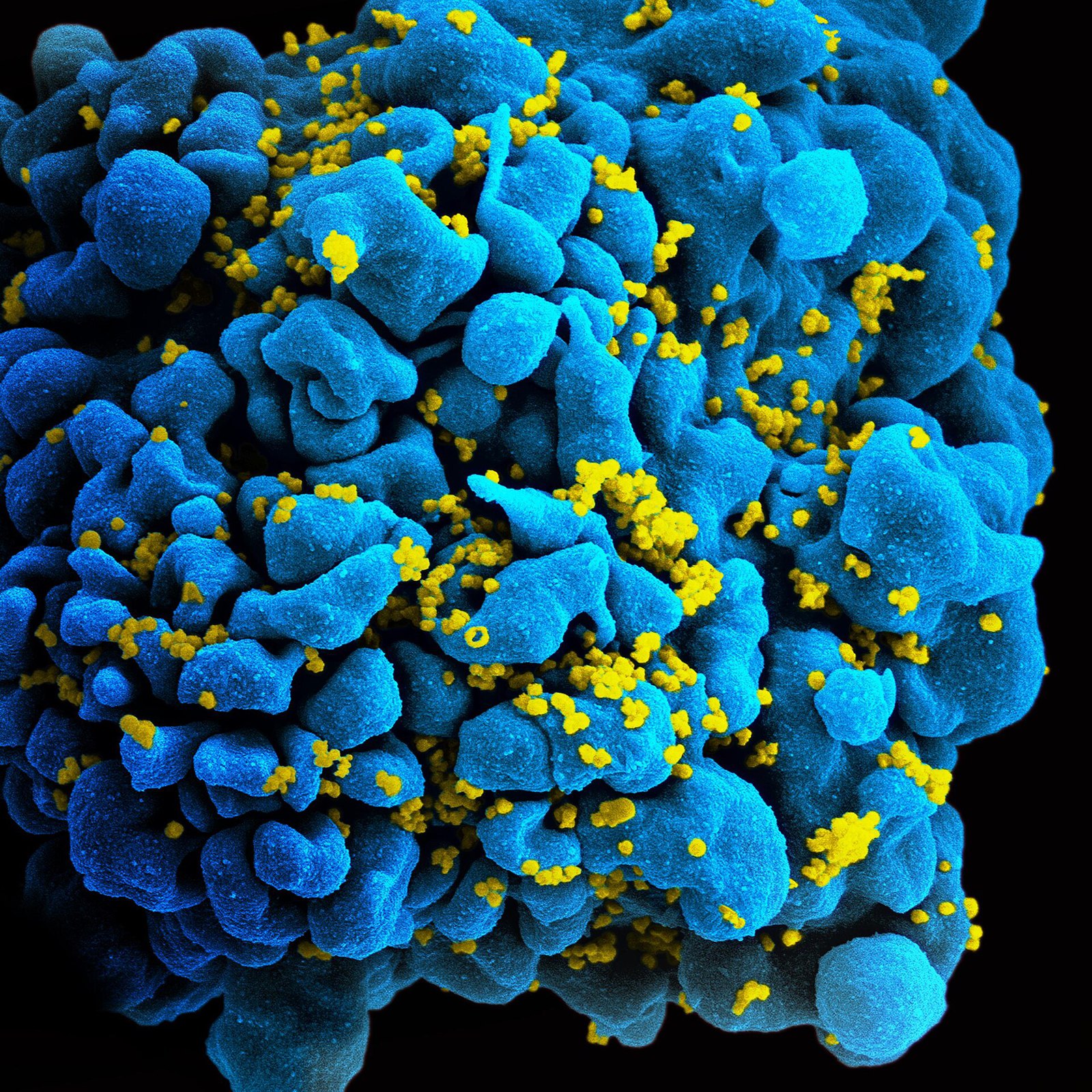 HIV-infected T cell (6813384933)