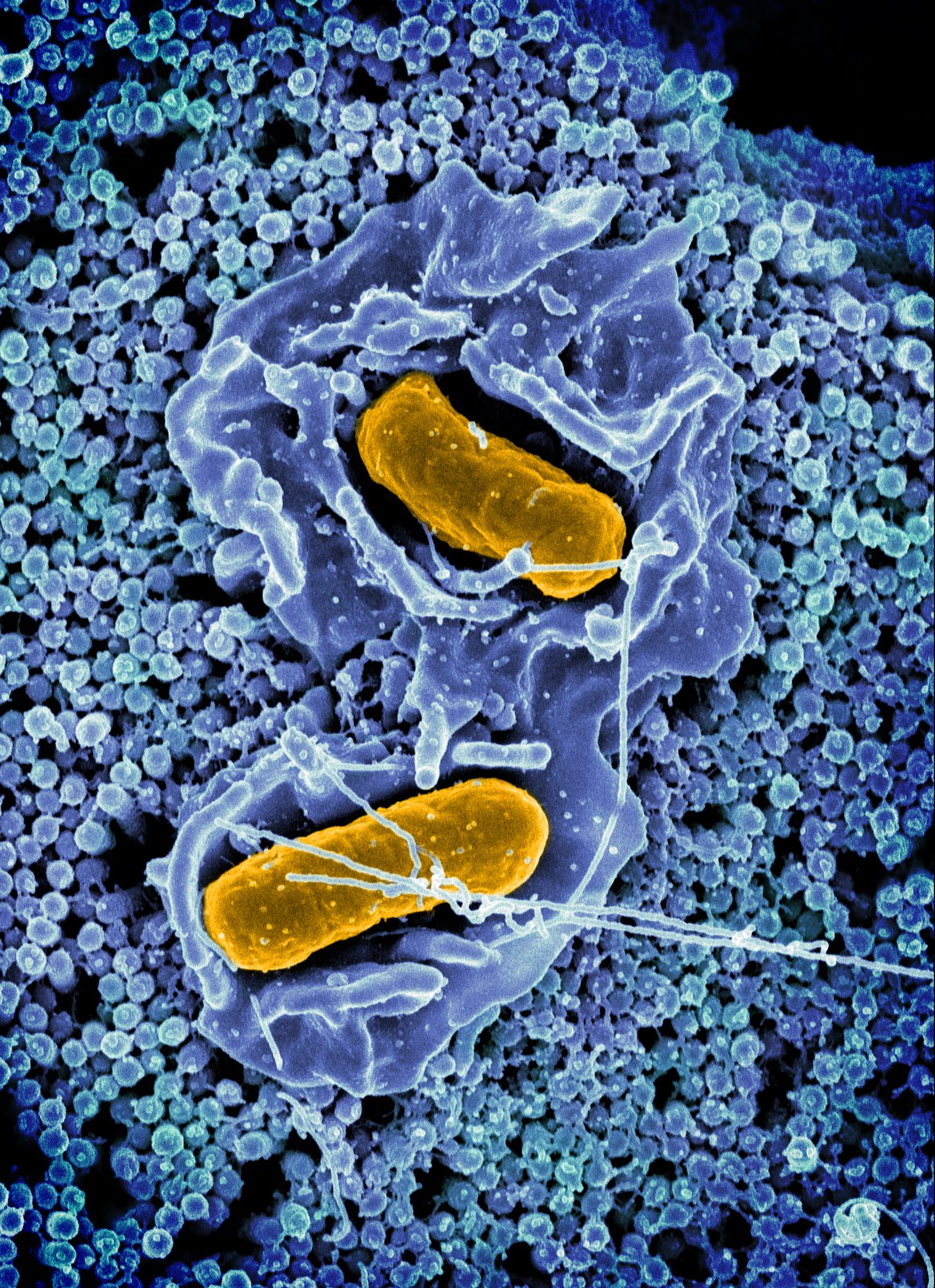 Salmonella Typhimurium invading a human epithelial cell - Scanning electron micrograph