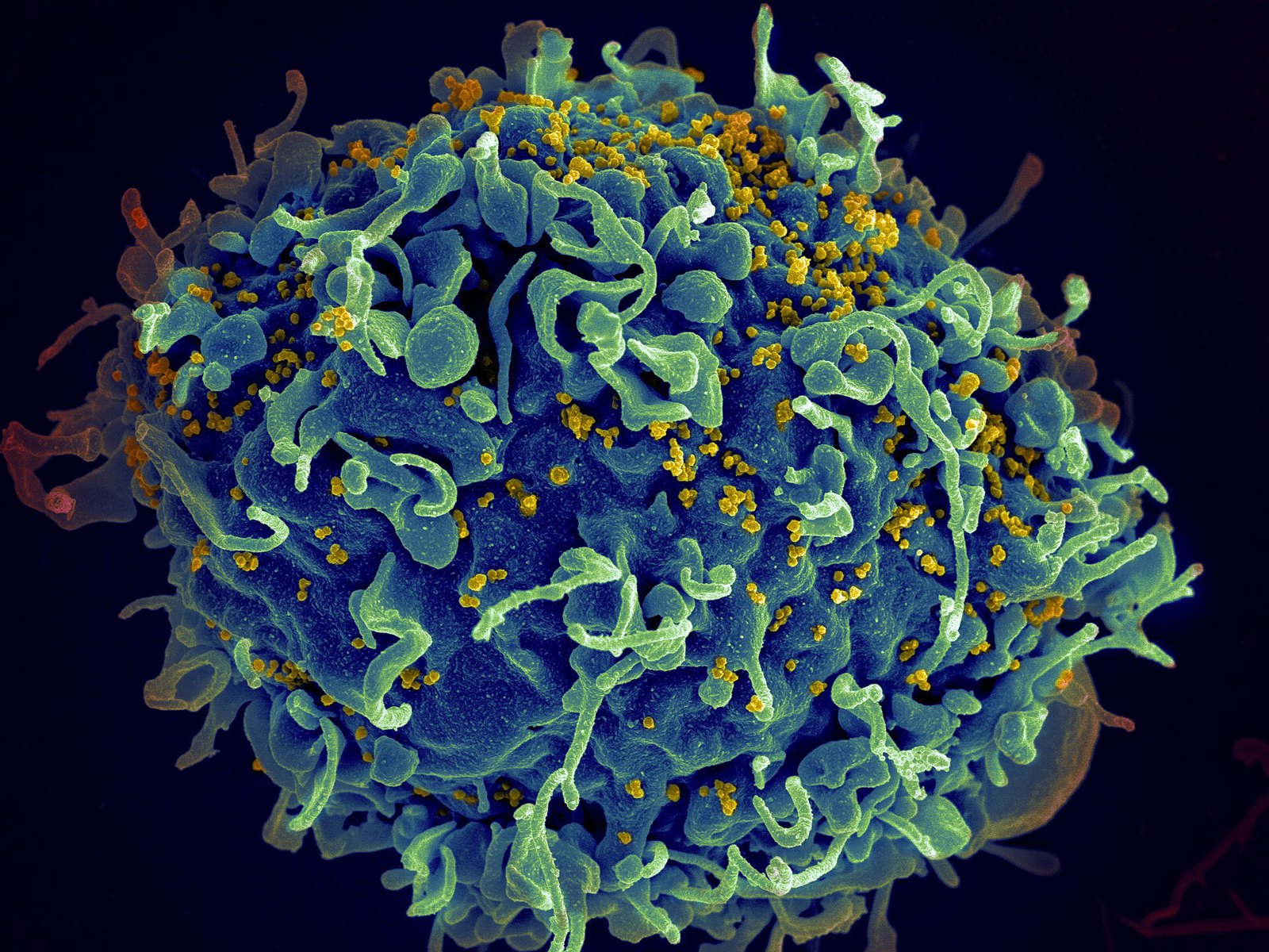 Scanning electron micrograph of a human H9 T cell infected with HIV virus particles