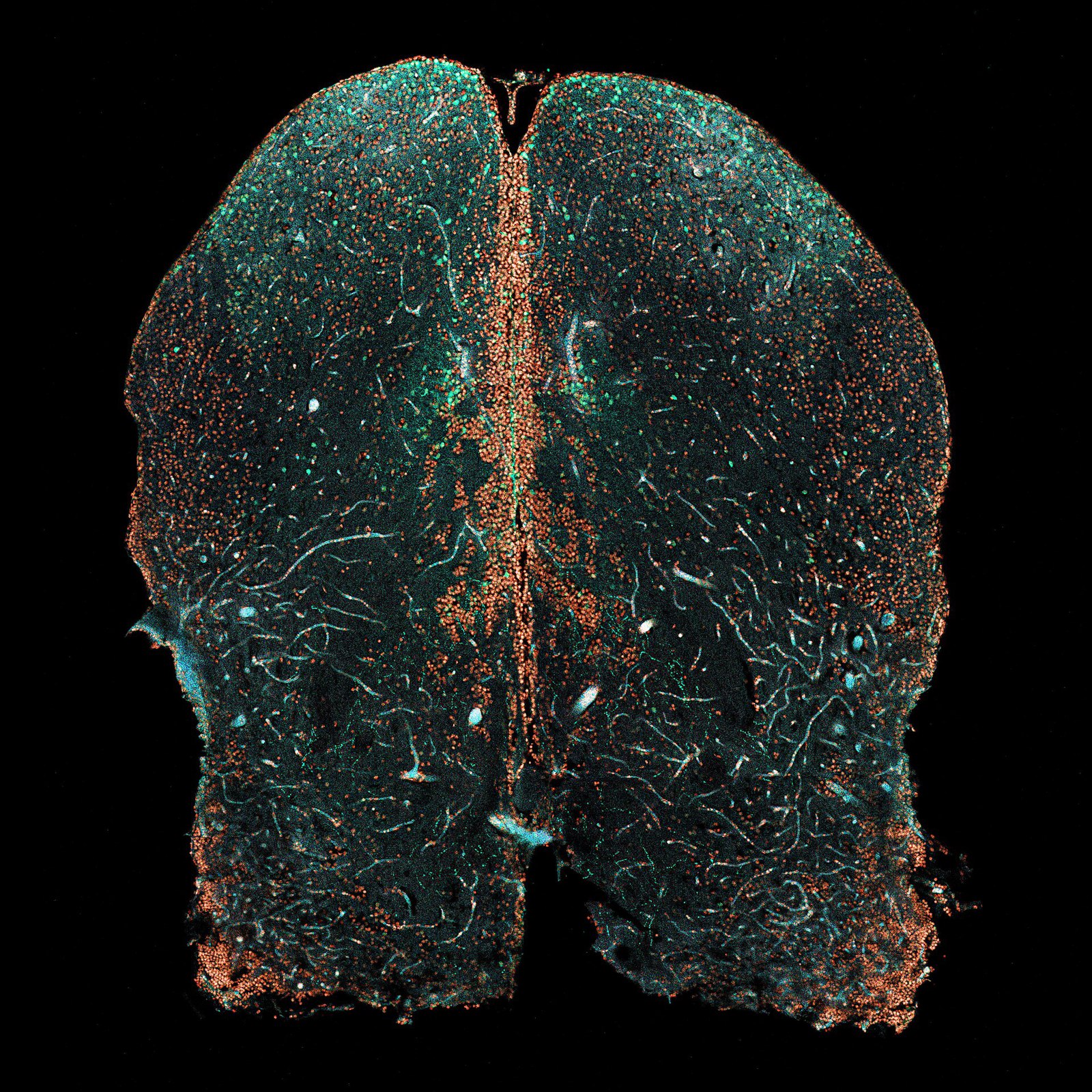 Corte cerebro pez cebra visto con microscopio confocal
