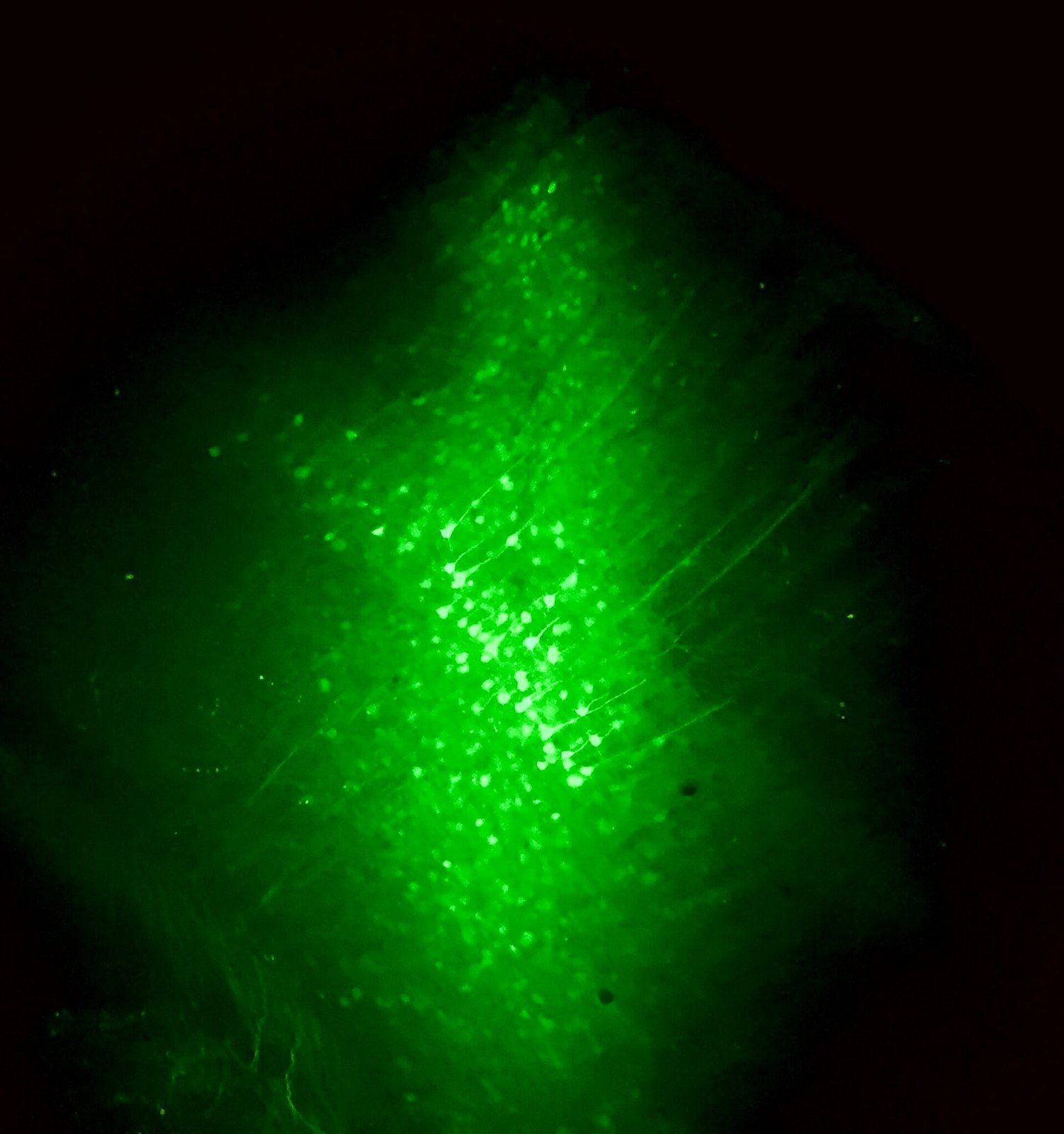 Cortical neurons