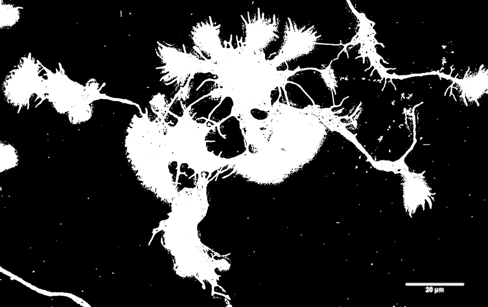 SUM 110913 Cort Neurons 2.5d in vitro 488 Phalloidin no perm 4 cmle-2