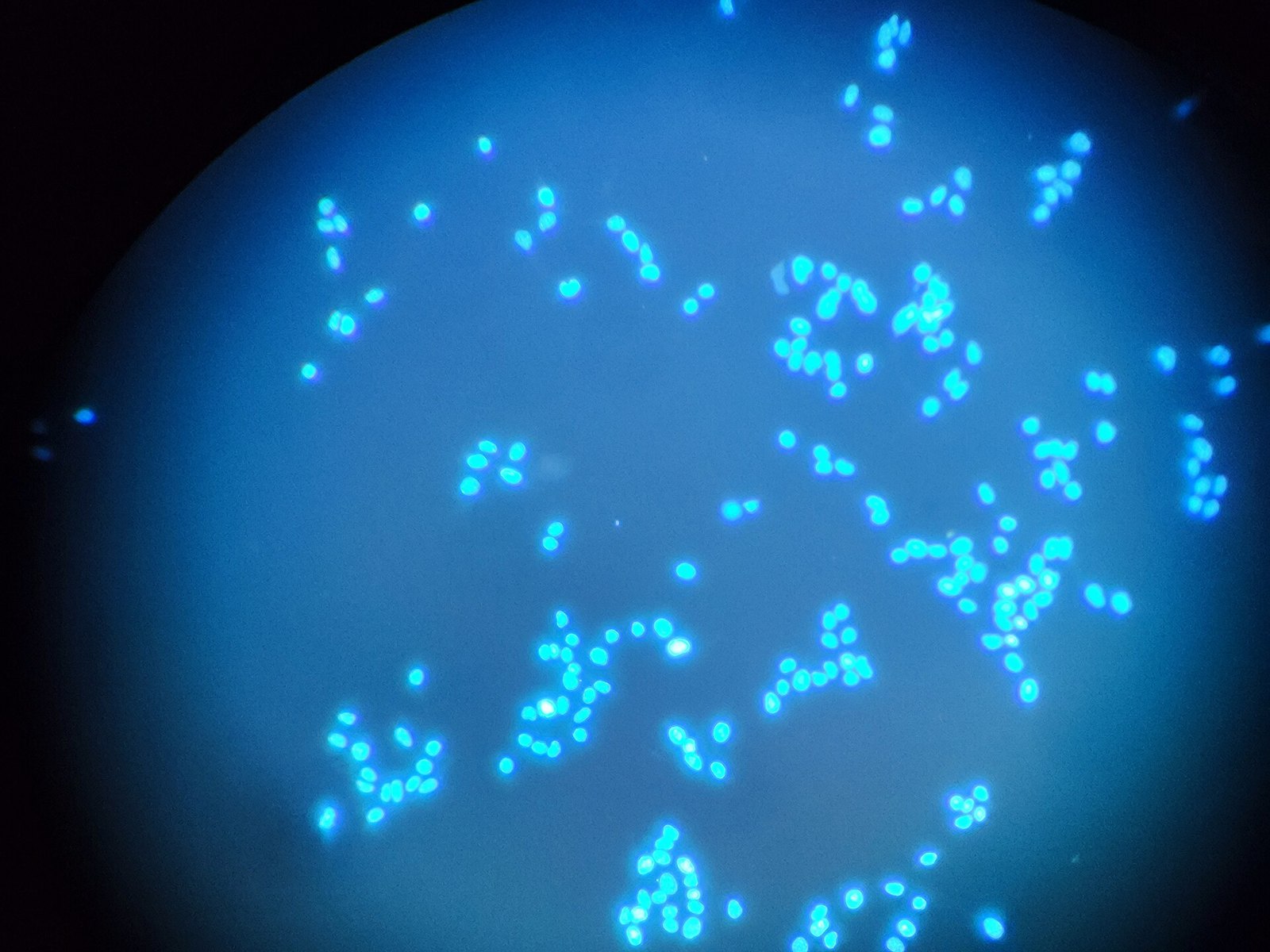Fluorescence microscopy of the DNA of the oral cancer cells