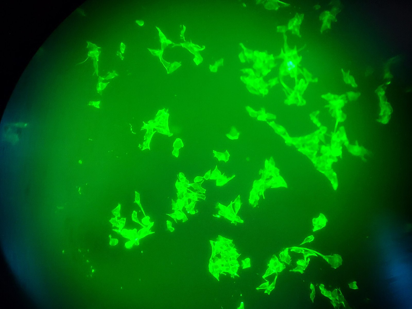 Fluorescence microscopy of the oral cancer cells