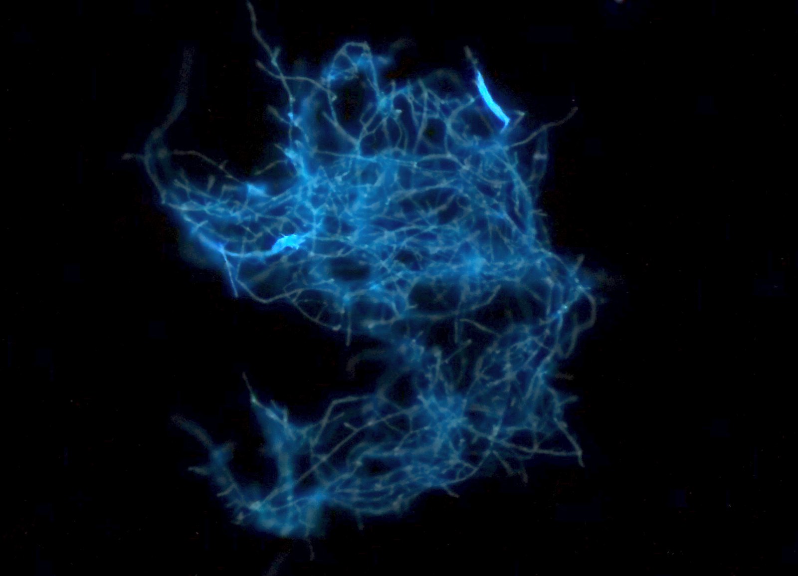 Fungi seen with fluorescence microscope