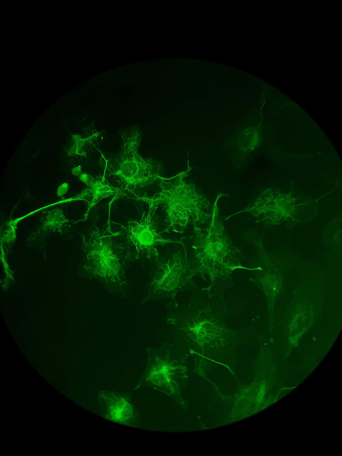 Green Fluorescence Microscopy