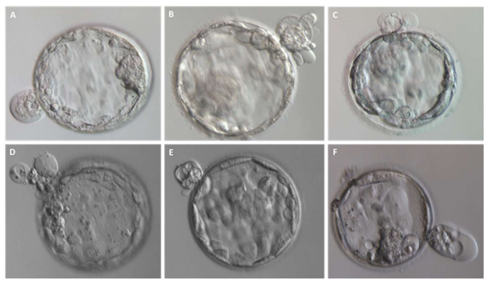Entire blastomeres are excluded upon blastocyst formation