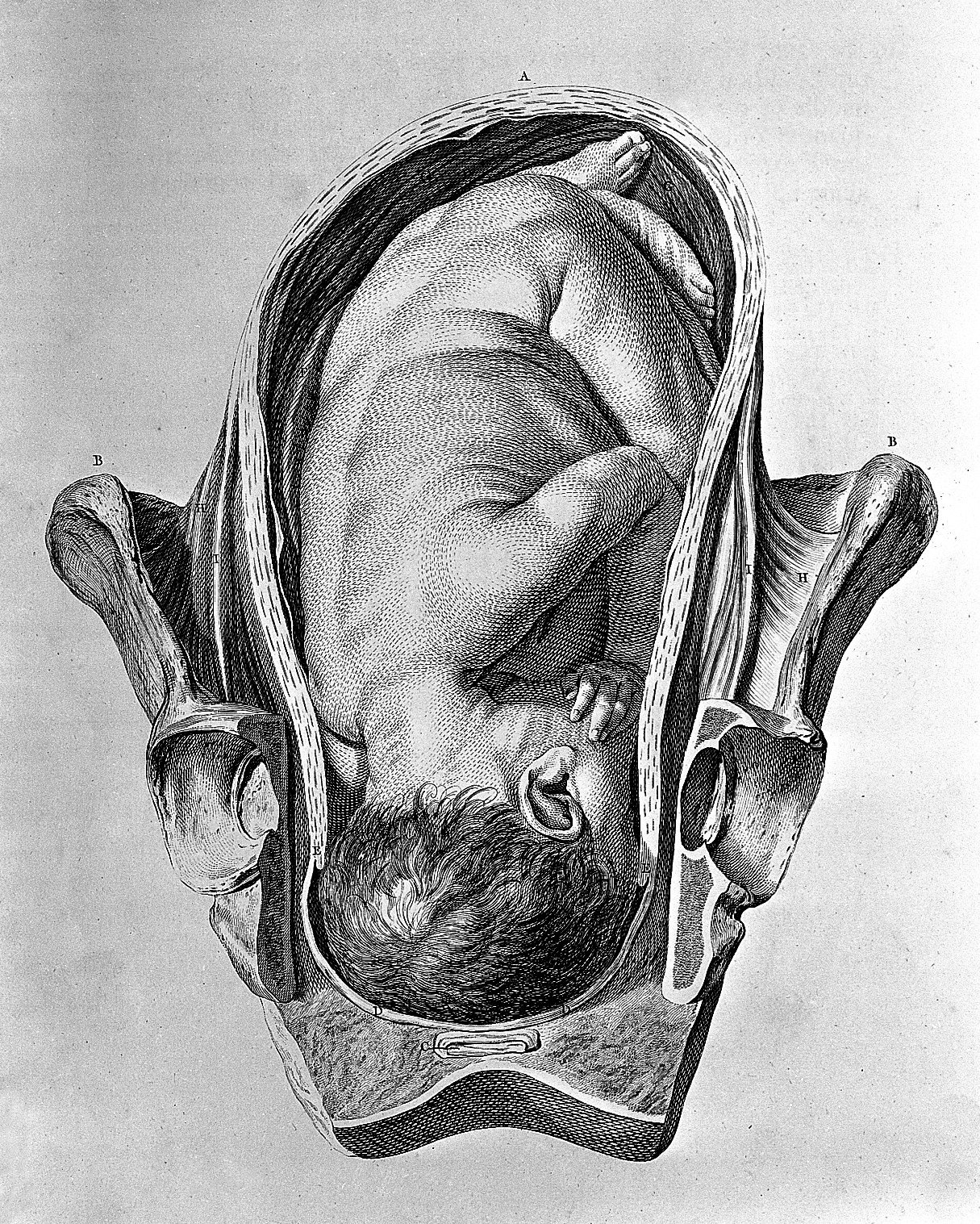 Foetus in utero. Wellcome L0004300
