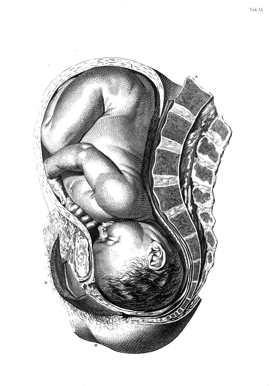 Foetus in utero. Wellcome L0013509