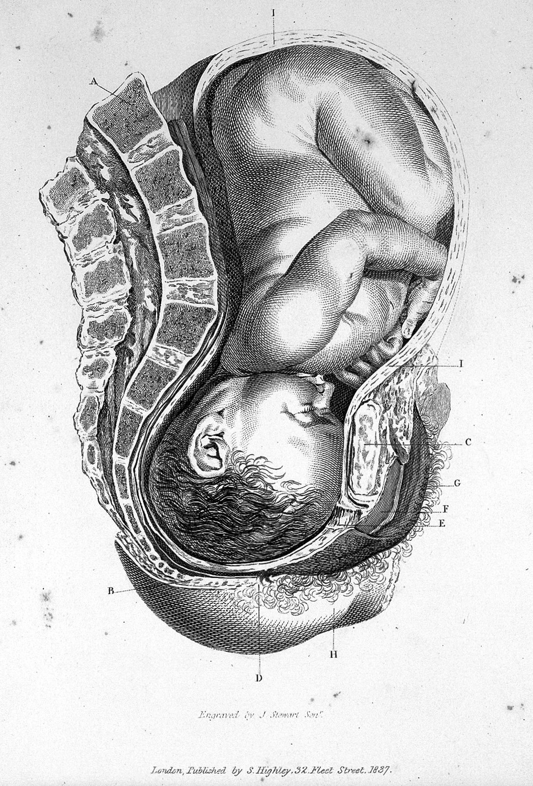 Foetus in utero. Wellcome L0018065