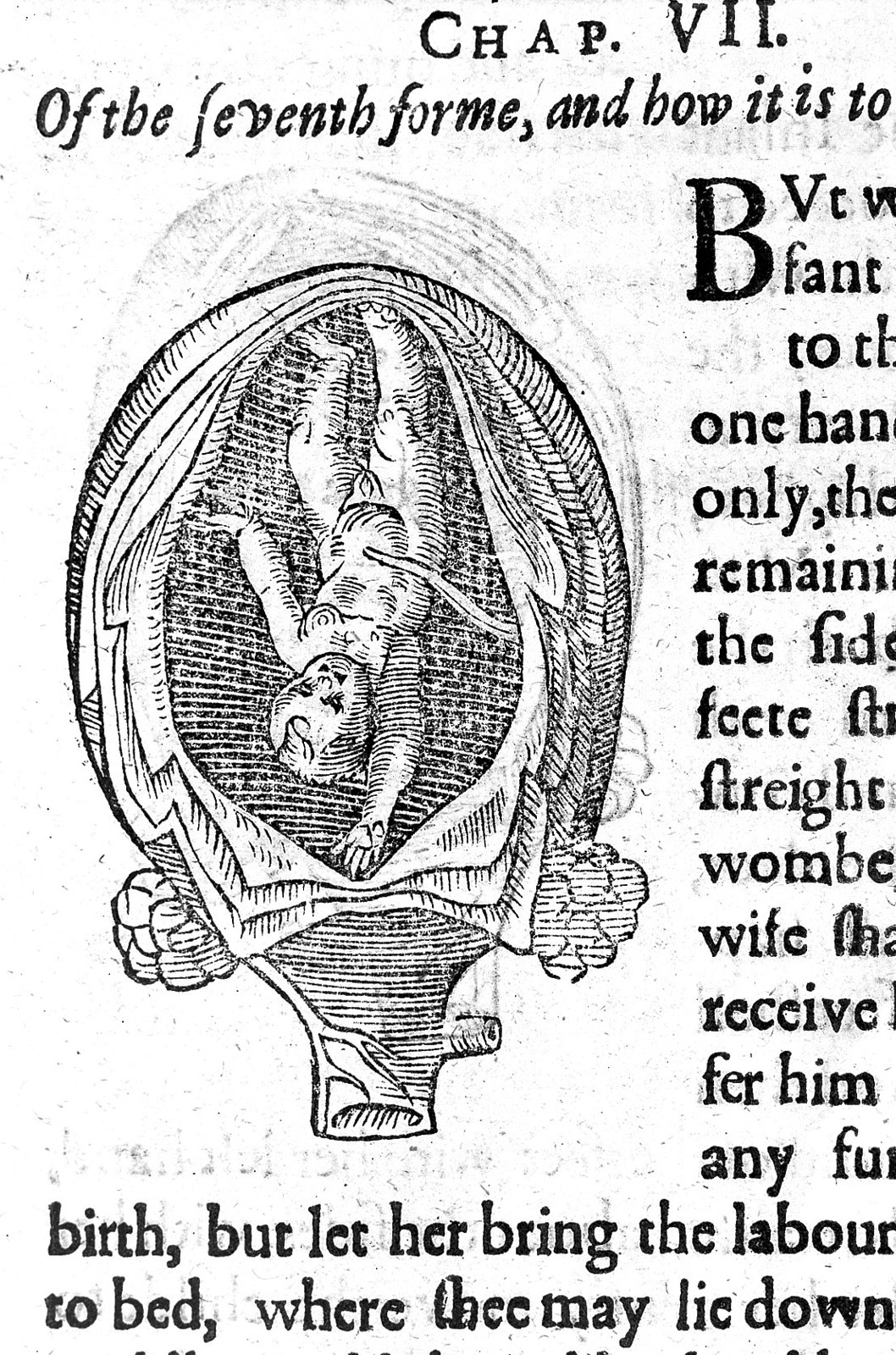 Foetus in utero from Rueff "Expert midwife" Wellcome L0014439
