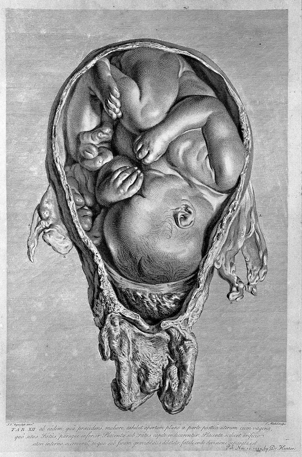 The anatomy of the human gravid uterus; foetus in utero. Wellcome L0004302