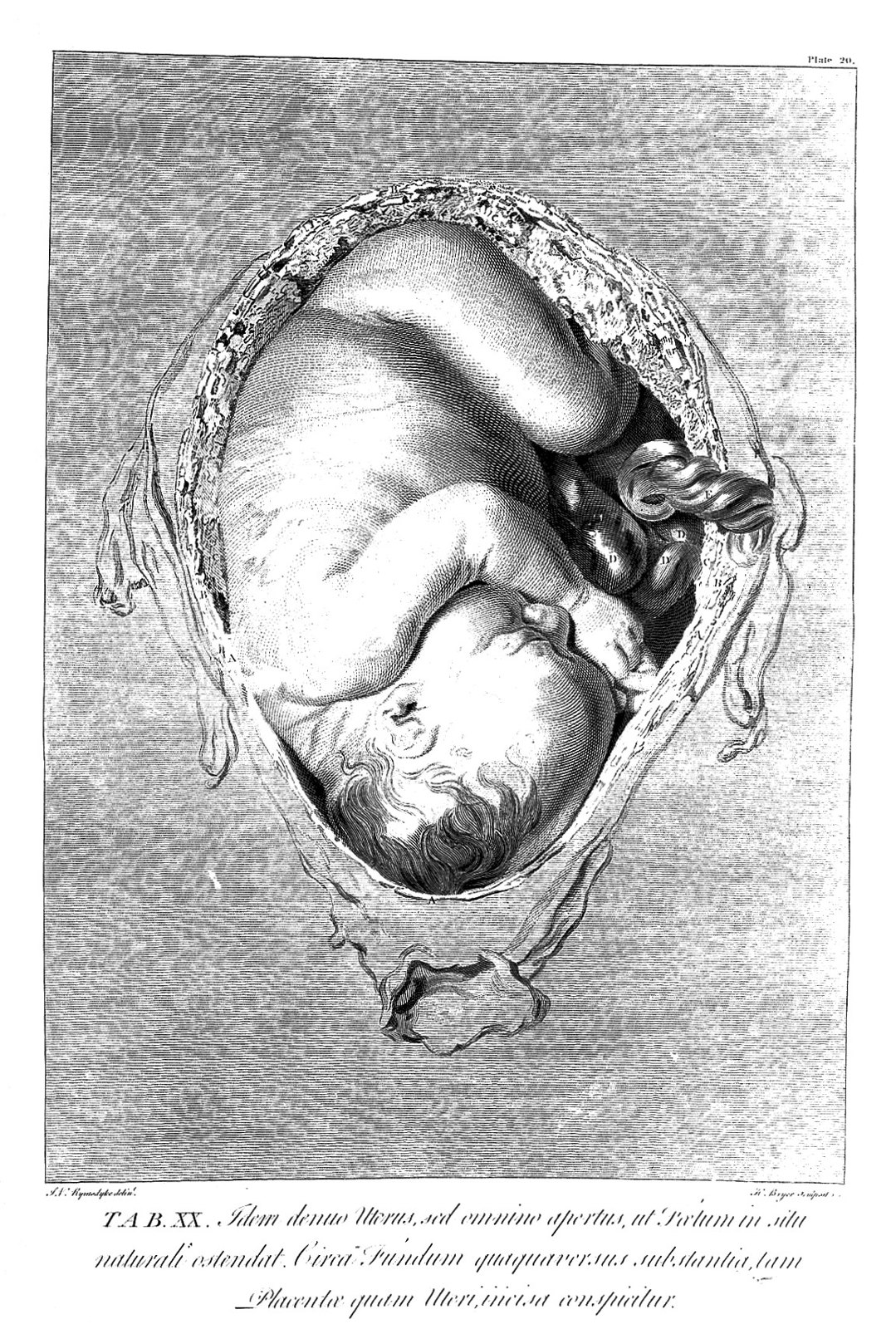 The anatomy of the human gravid uterus; foetus in utero. Wellcome L0007000