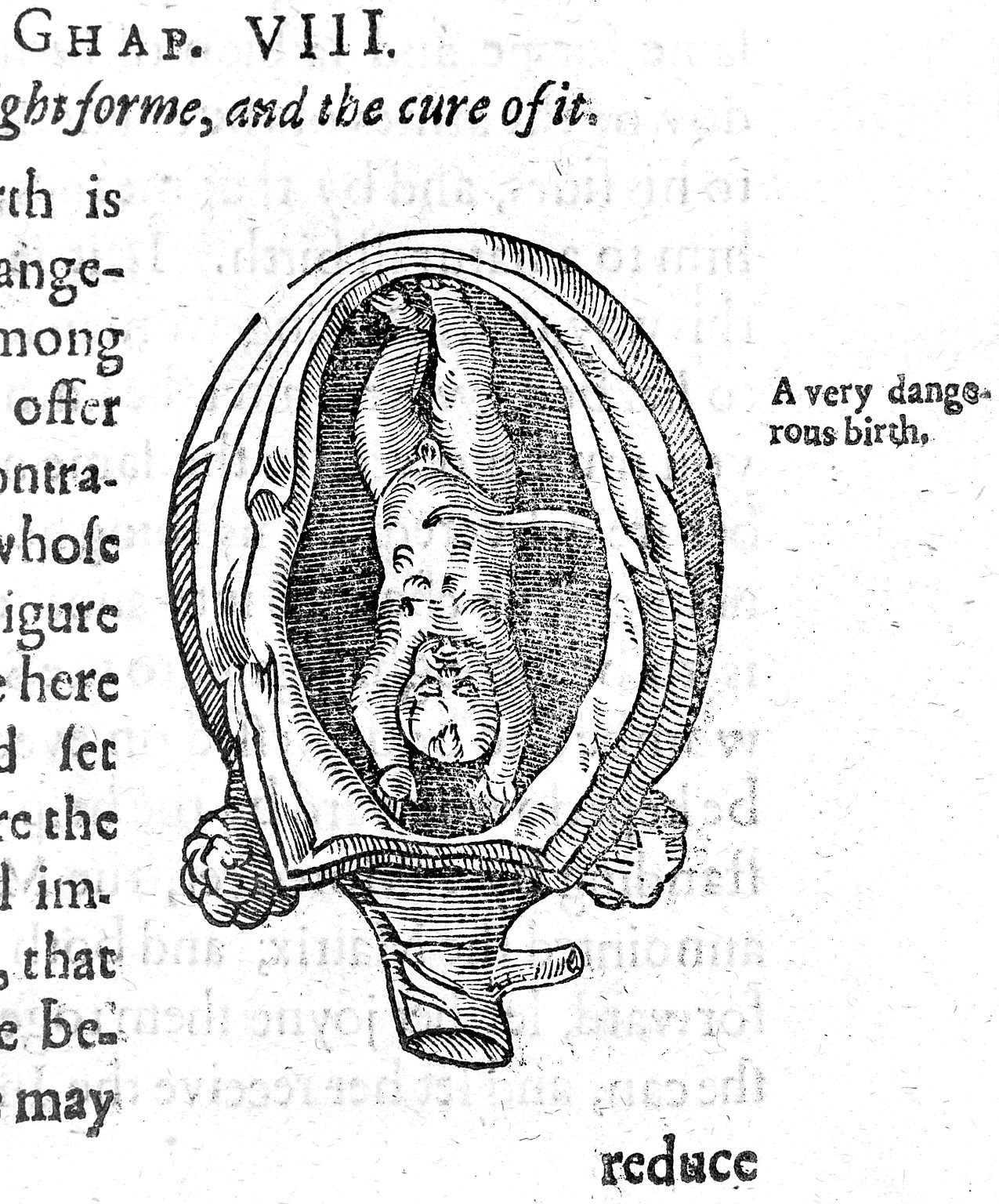 Woodcut of foetus in utero Wellcome L0014440