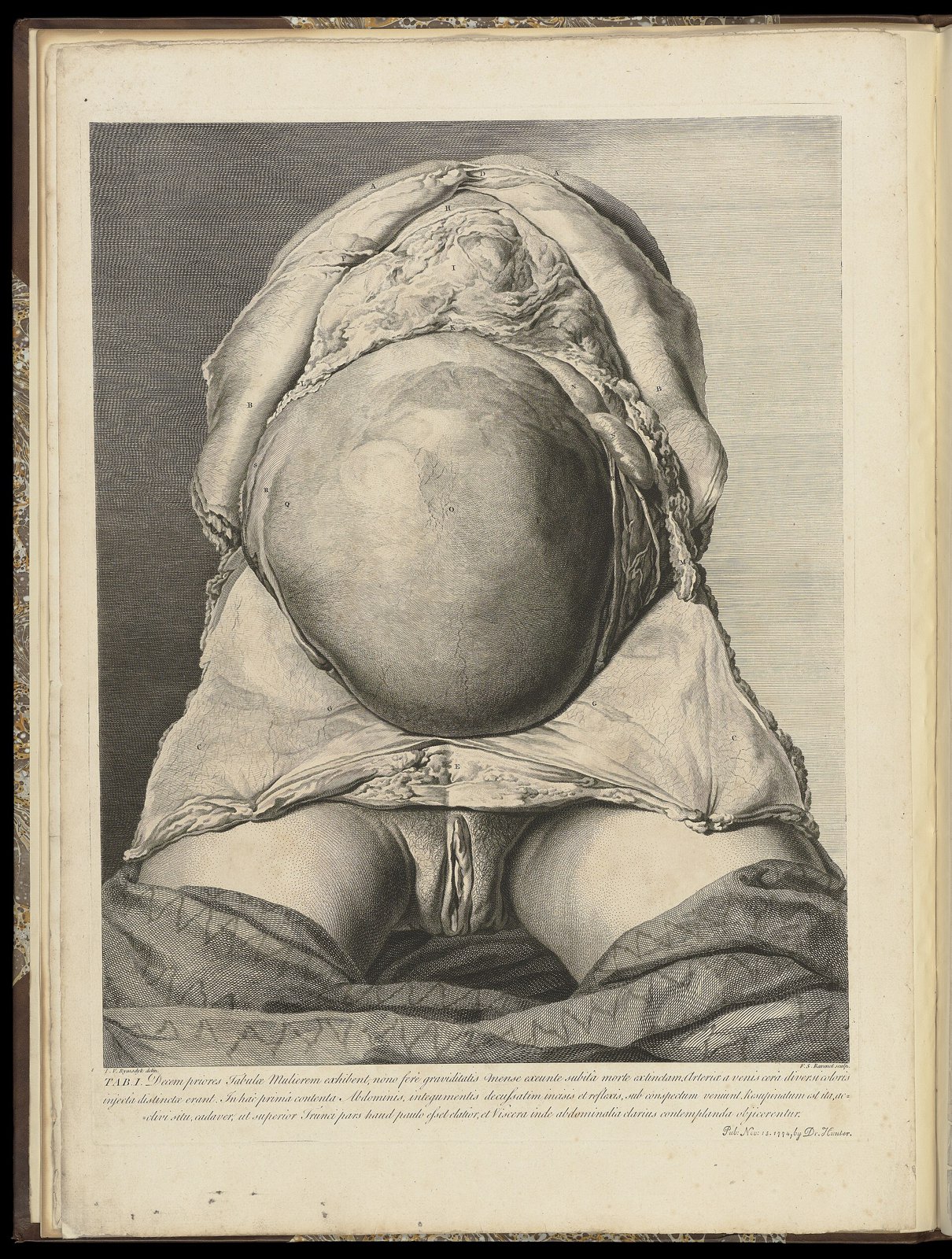The anatomy of the human gravid uterus exhibited in figures Wellcome L0050943