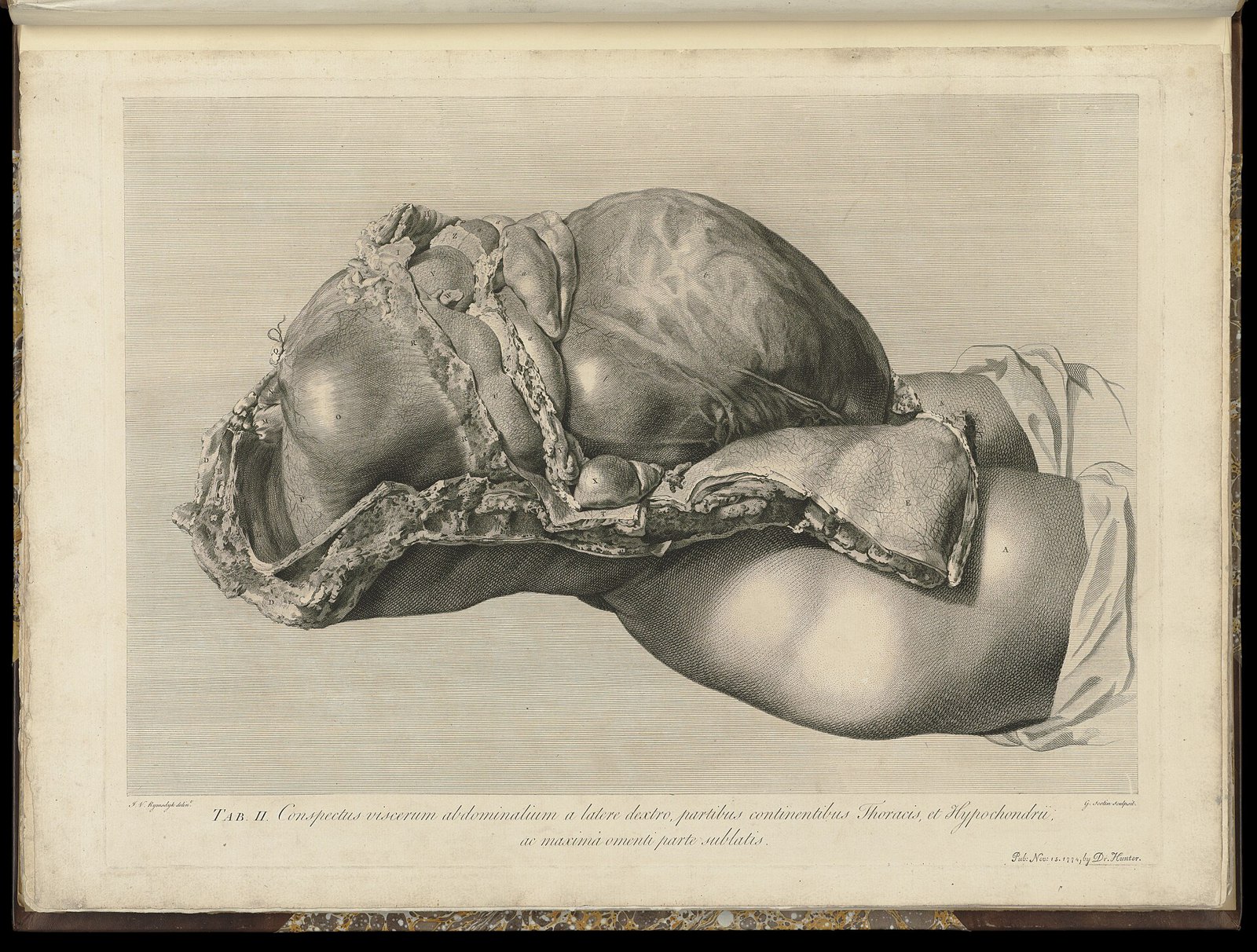 The anatomy of the human gravid uterus exhibited in figures Wellcome L0050946