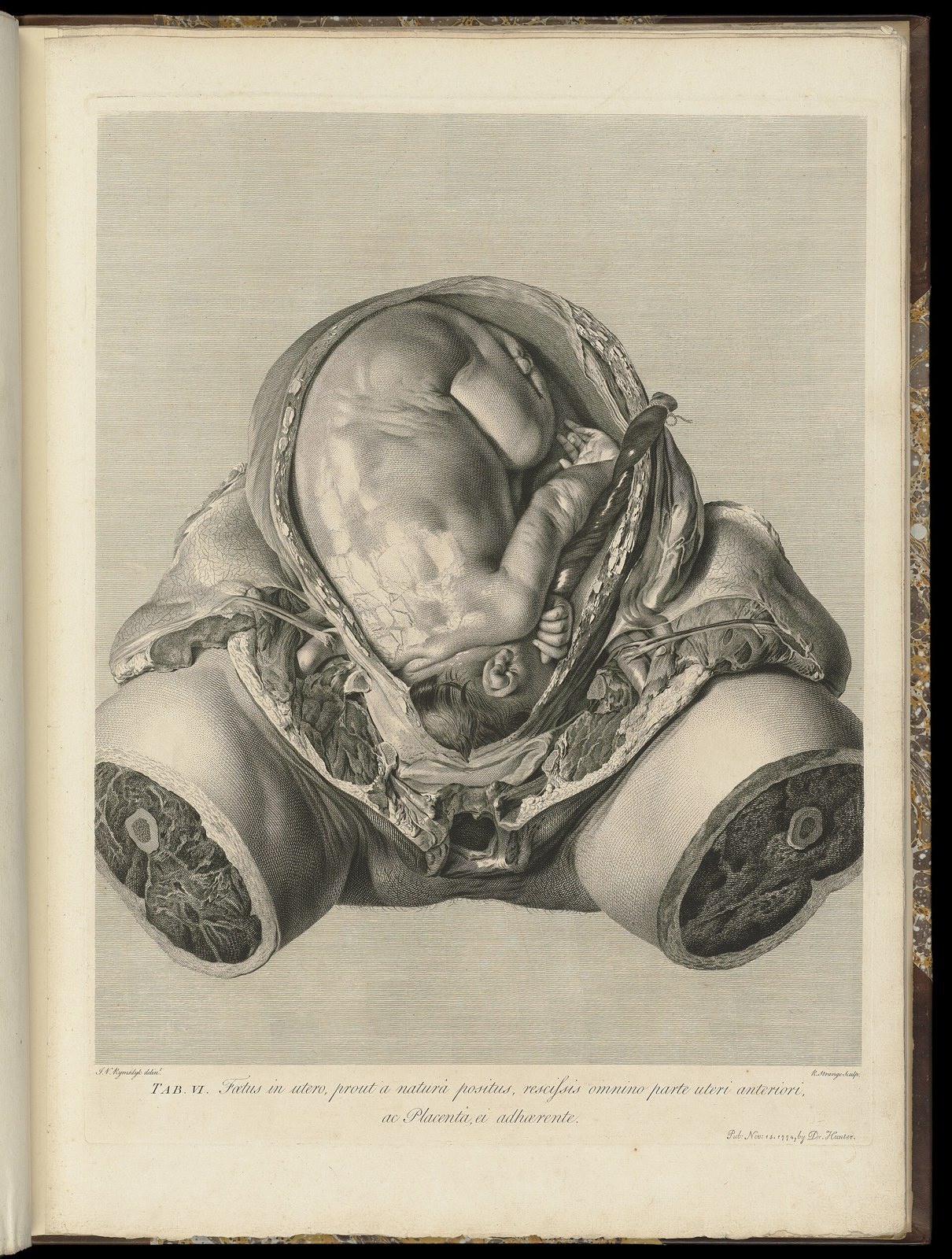 The anatomy of the human gravid uterus exhibited in figures Wellcome L0050958