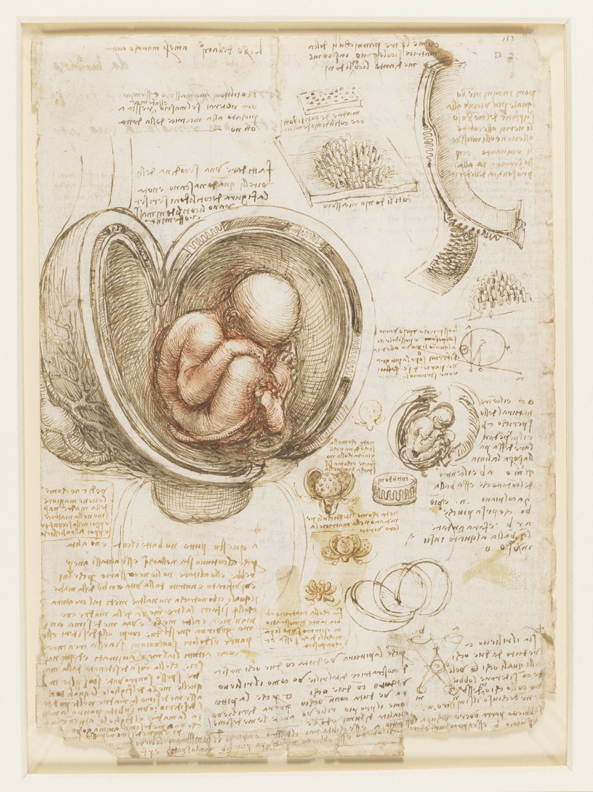 Leonardo da Vinci - RCIN 919102, Recto The fetus in the womb