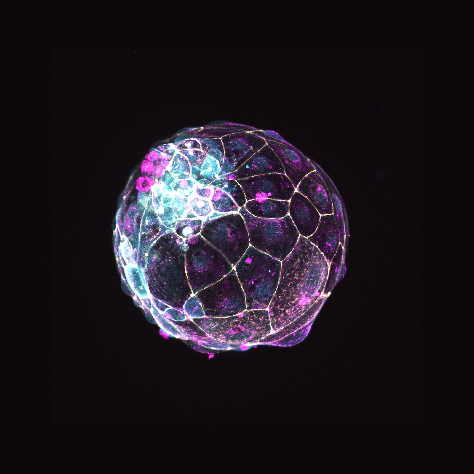 Human blastoid - 1