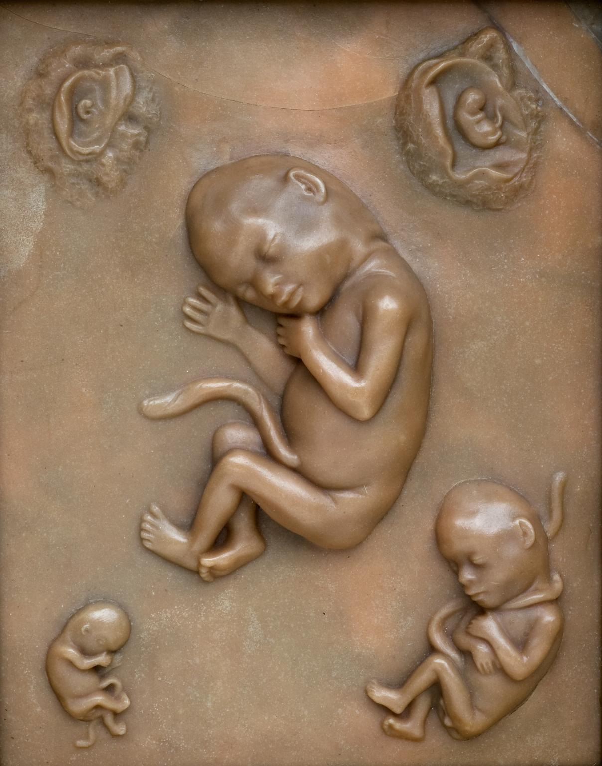 Plaque showing the development of a human embryo 2