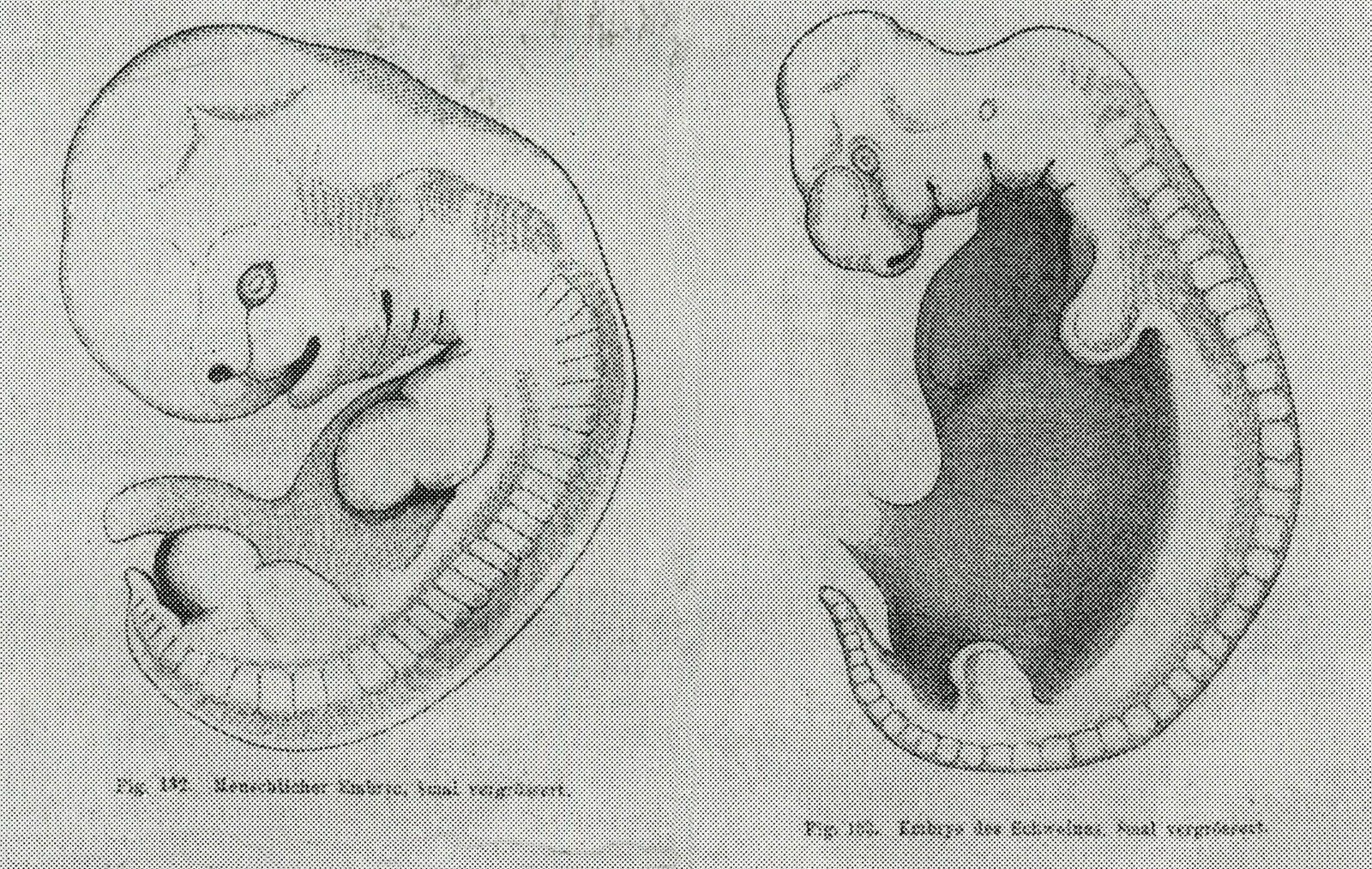 His-Embryo