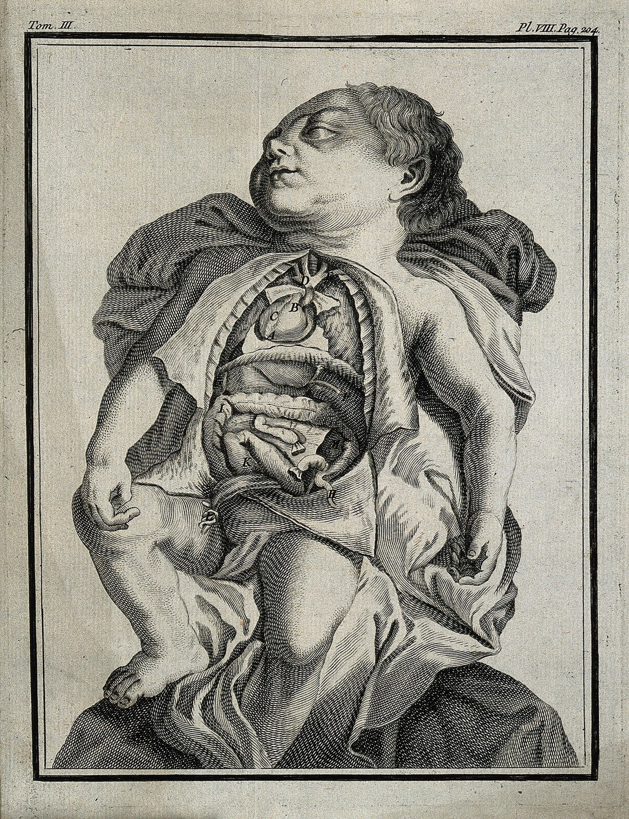 A child born with the viscera reversed. Engraving, 1749. Wellcome V0007821