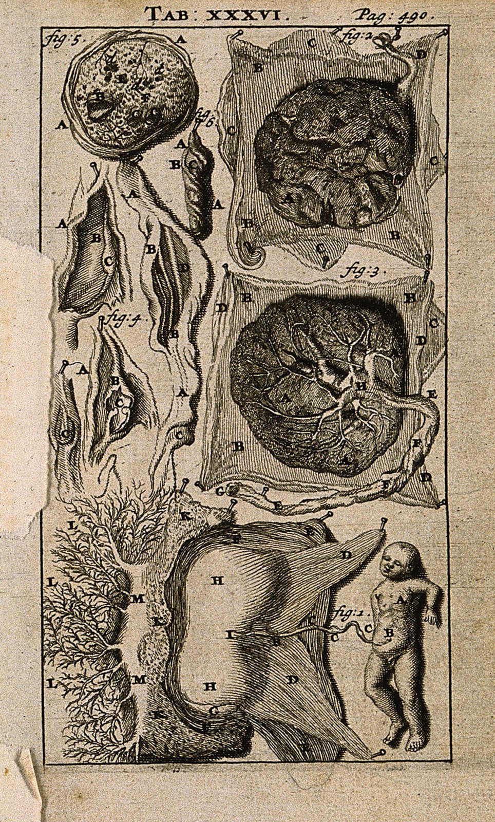 A foetus and placenta with umbilical cord. Engraving, 1686, Wellcome V0007786ER