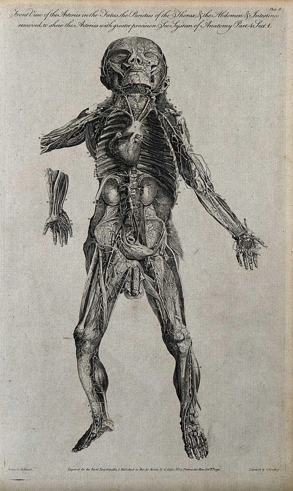Dissected foetus seen from the front, with arteries indicate Wellcome V0007990