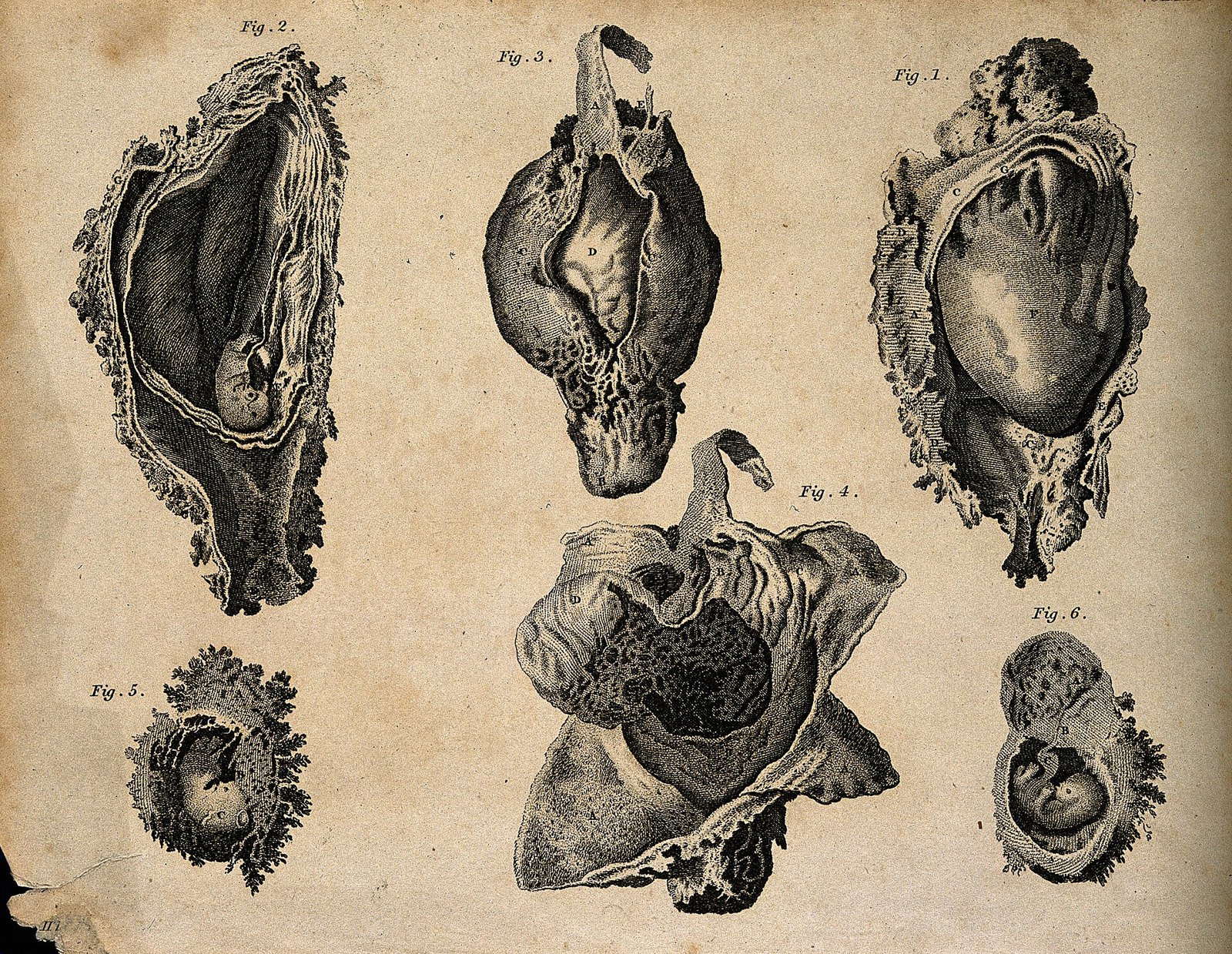 Foetus in utero; six figures. Stipple engraving by Campbell( Wellcome V0008049