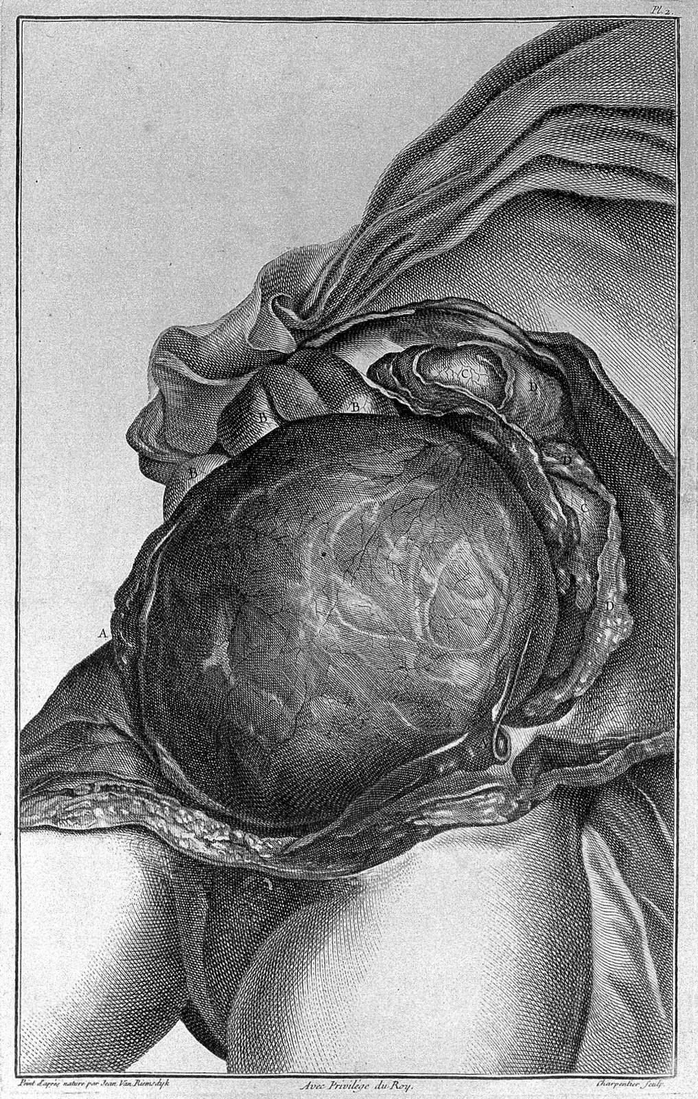 Jenty; anatomy of the womb and foetus Wellcome L0030022
