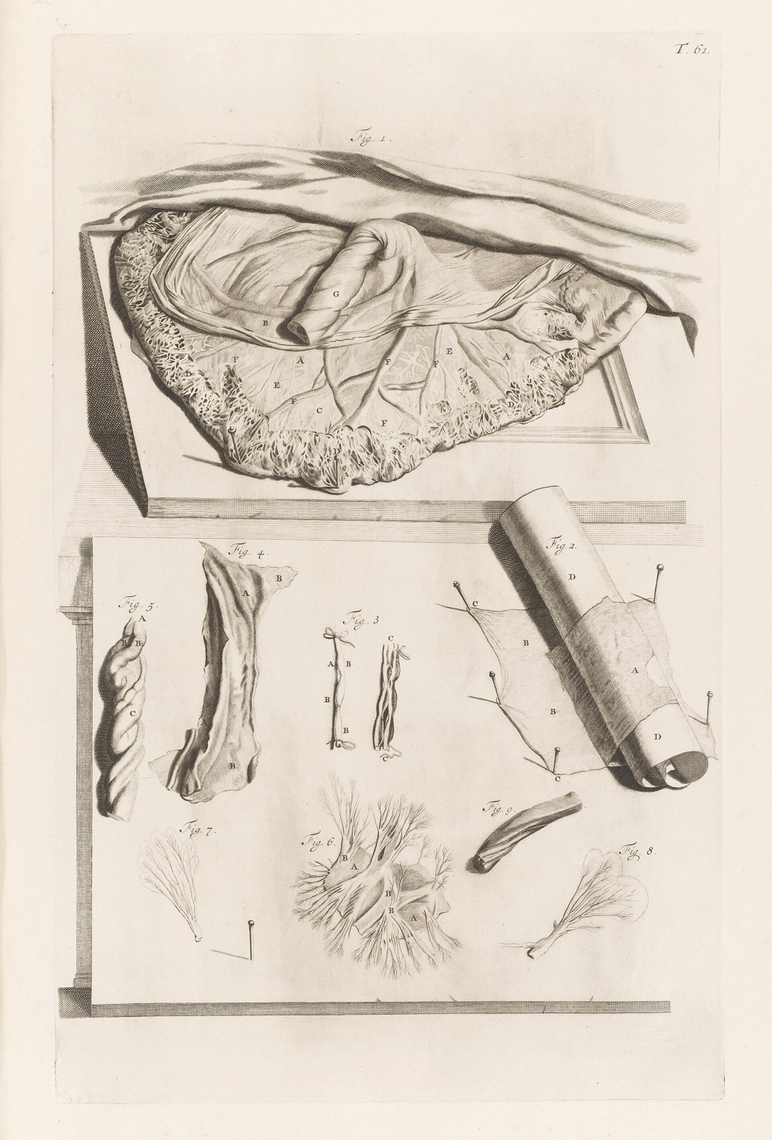 Illustration of a placenta Wellcome L0051128