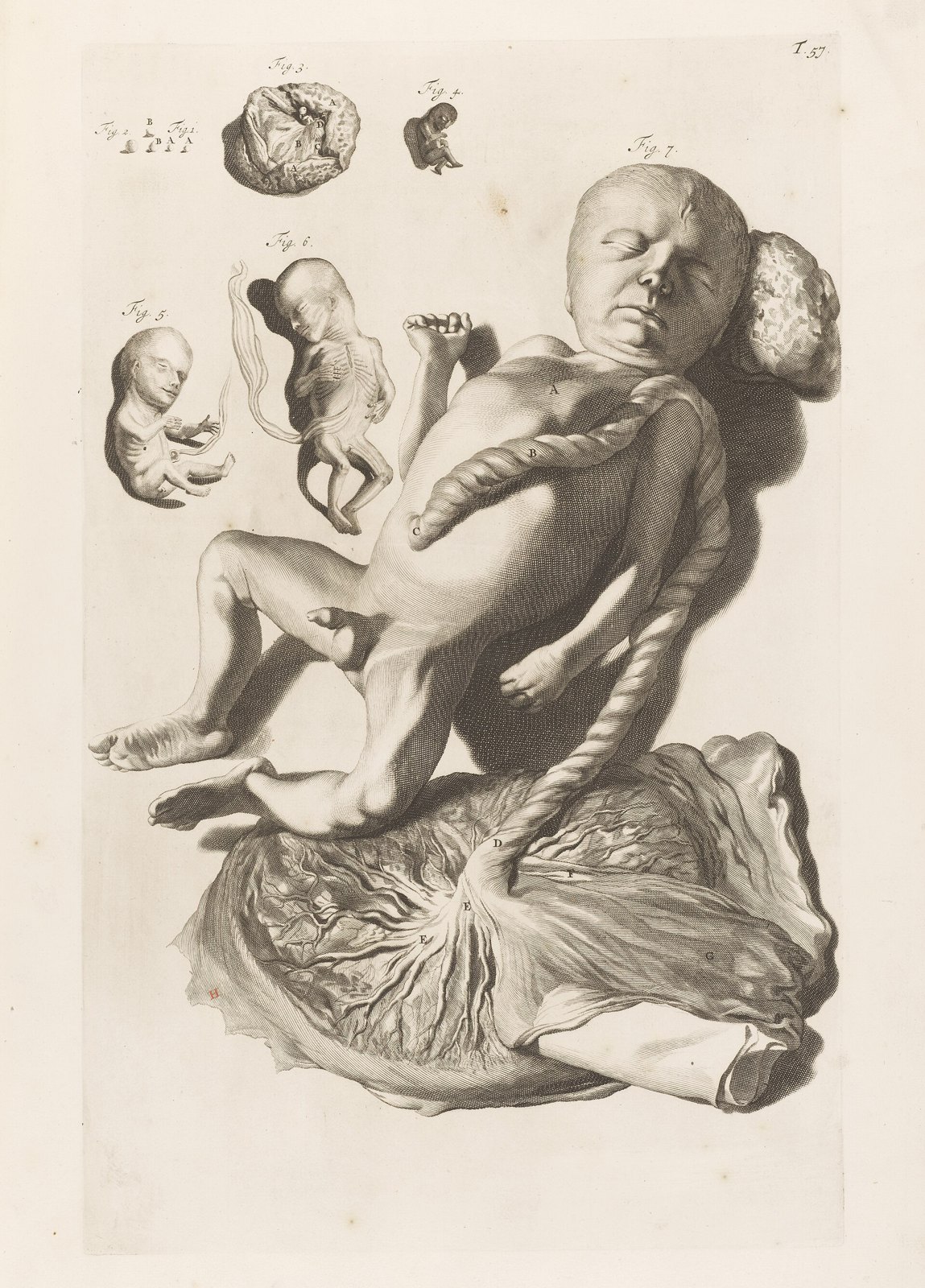 Illustration of male foetus with placenta Wellcome L0051127