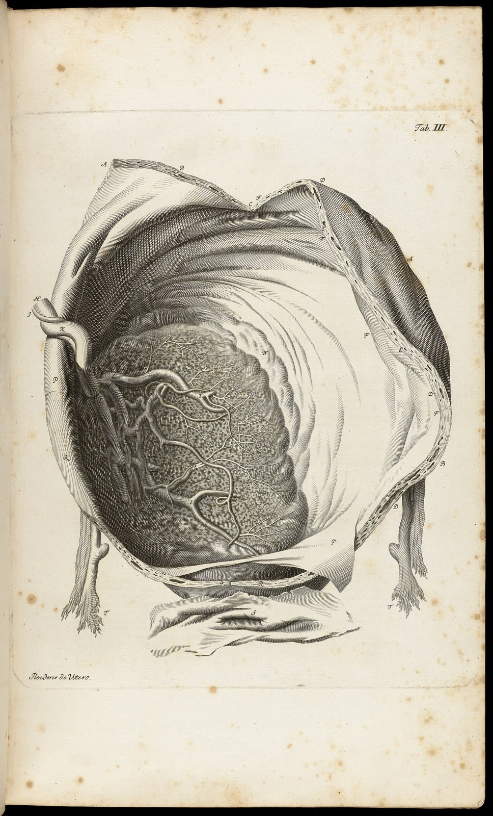 Tab III; Placenta within amneotic sac Wellcome L0064774