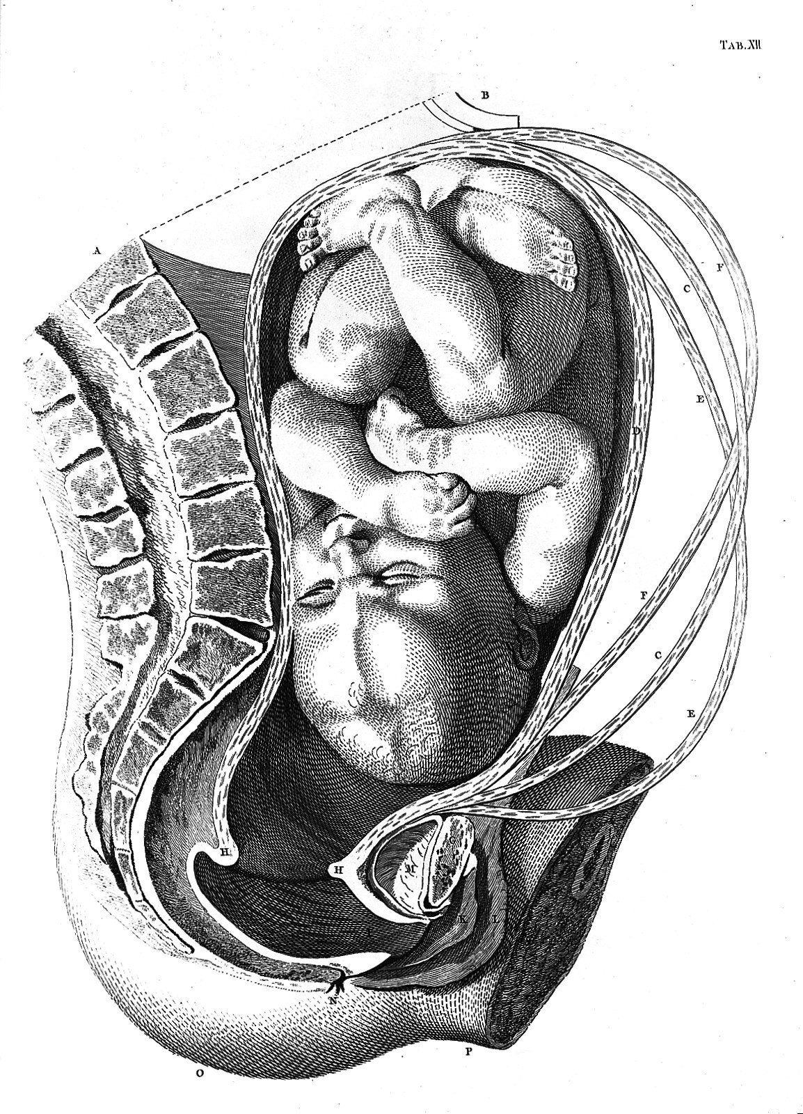 Foetus in utero. Wellcome L0013508